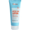 Derma telové mlieko po opaľovaní, 200 ml
